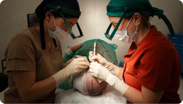 Jak dlouho vydrží transplantace vlasů?