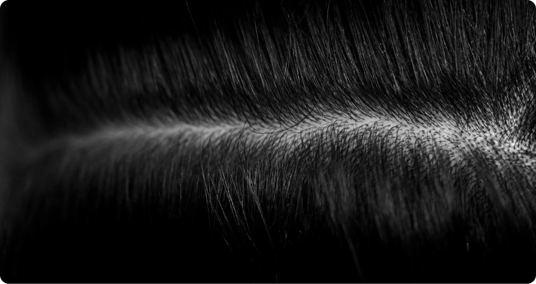 Detailní foto vlasové linie