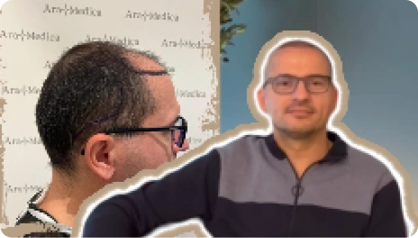 Recenze Jirka: Transplantace vlasů po padesátce