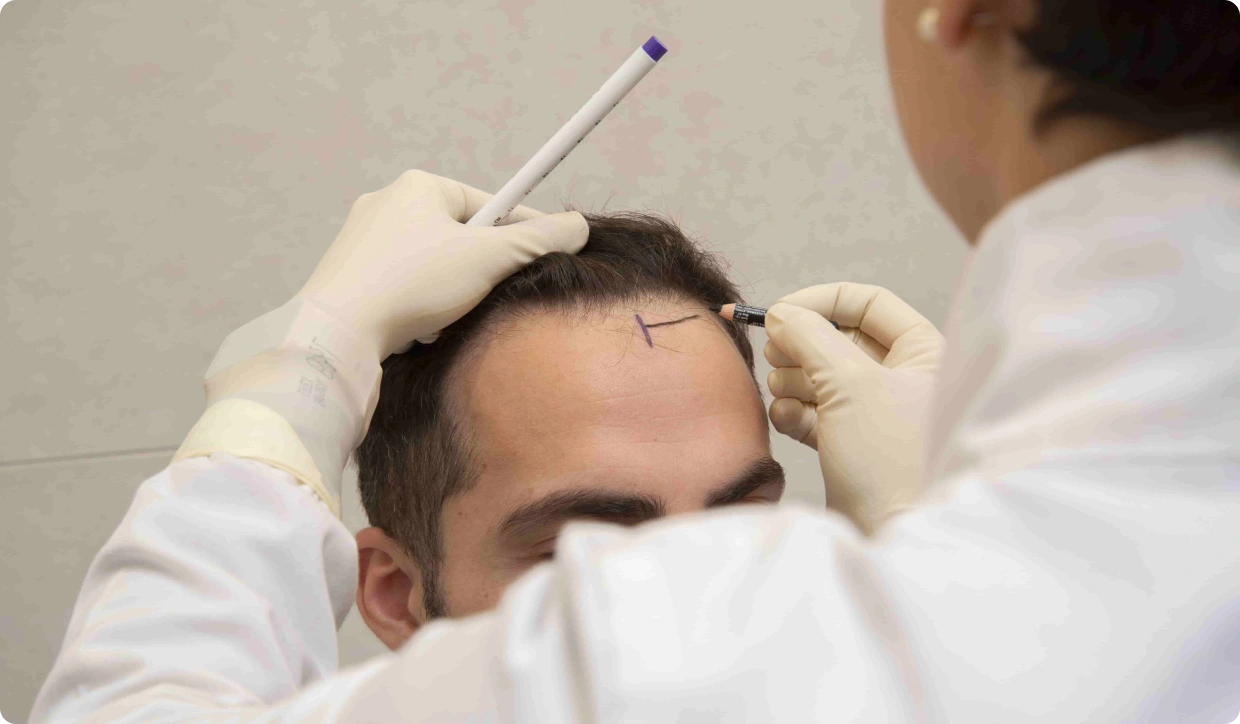 Zdravotnický pracovník kreslí fialovou značku na hlavu pacienta