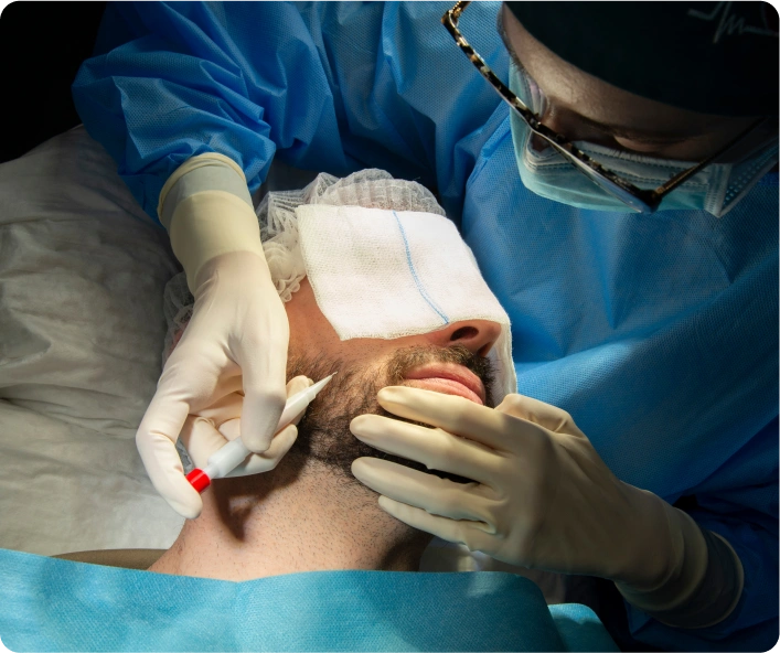 Transplantace metodou BHT