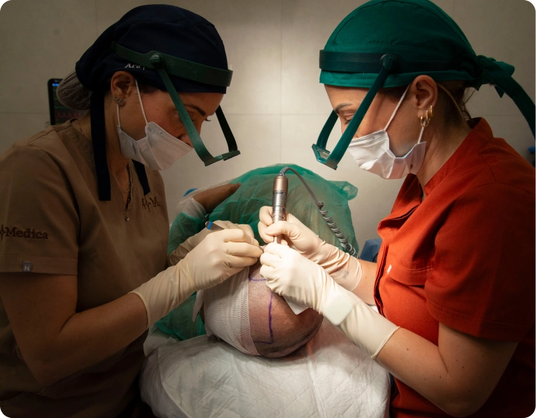 Transplantace vlasů metodou DHI