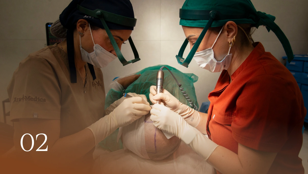 Zdravotnice v ochranných štítech a rukavicích provádějí transplantaci vlasů u pacienta