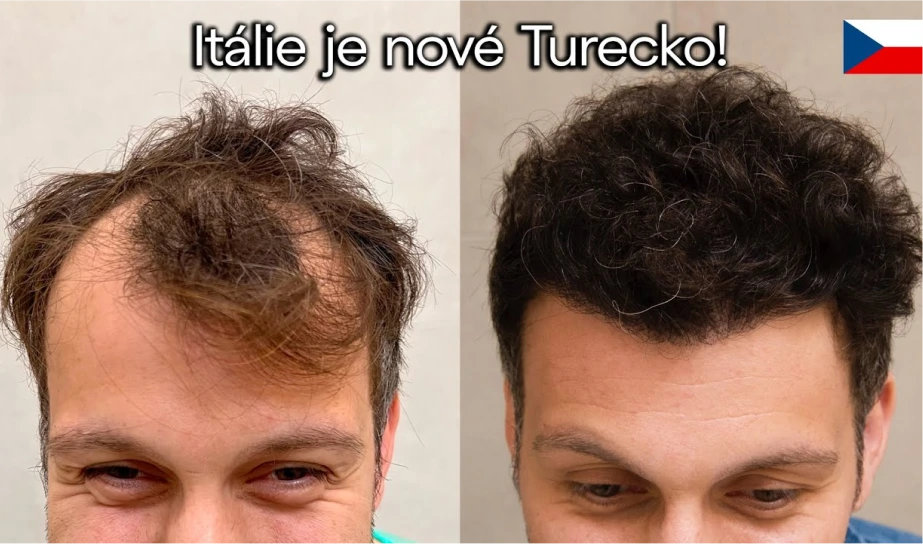 Video Italské kliniky AraMedica